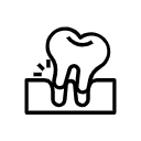 Root debridement